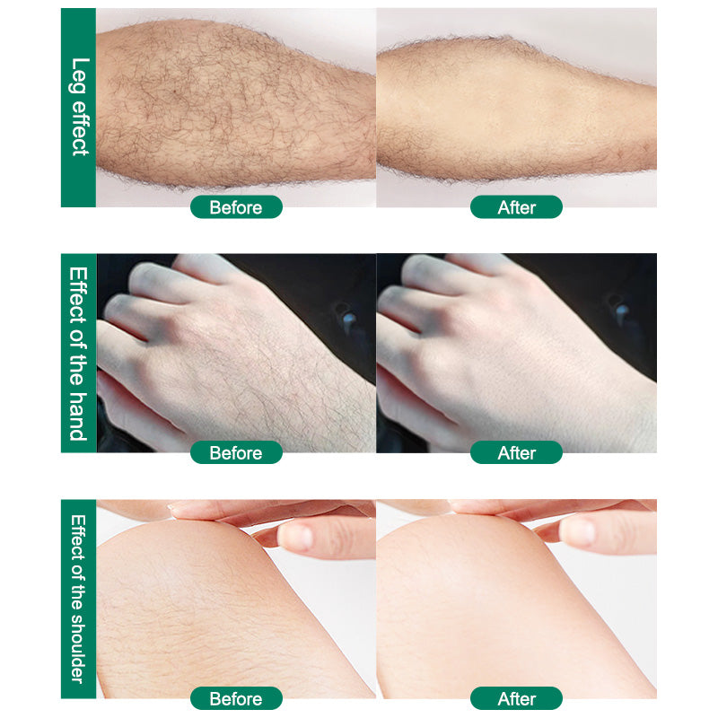 CJEER Upgraded Magic Crystal Hair Eraser For Women And Men