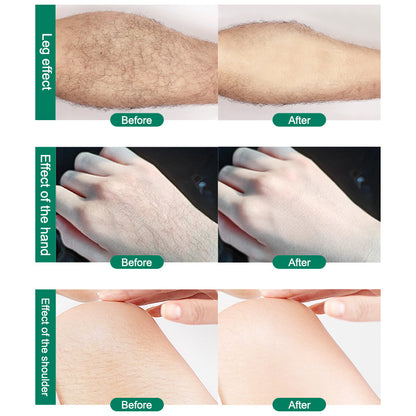 CJEER Upgraded Magic Crystal Hair Eraser For Women And Men
